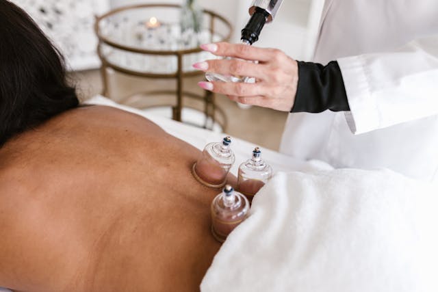 Cupping Therapy